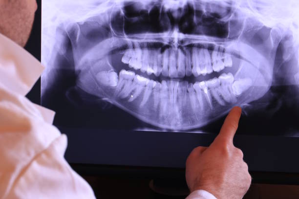 Best Emergency Treatment for Dental Infections or Abscesses in Rancho Murieta, CA