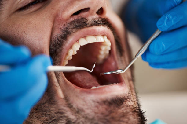 Best Weekend Emergency Dentist in Rancho Murieta, CA